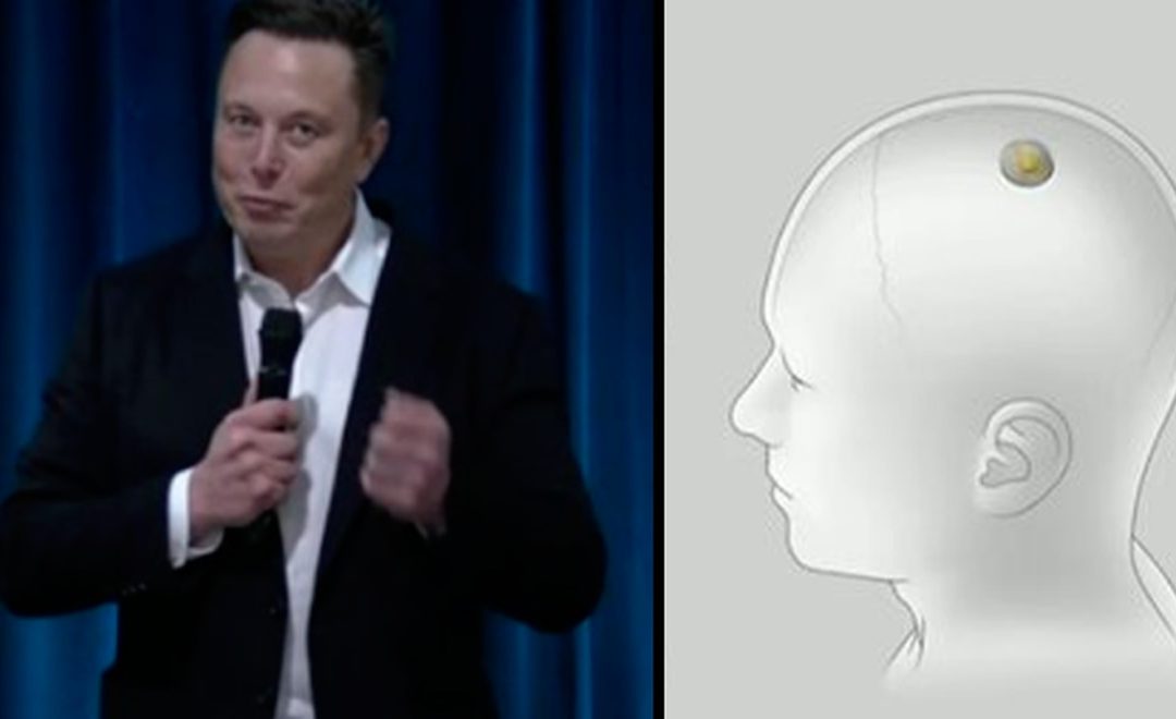 Chip De Neuralink Dominar El Cerebro Es El Nuevo Pasatiempo De Elon Musk – Hyenuk Chu