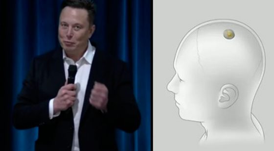 Chip De Neuralink Dominar El Cerebro Es El Nuevo Pasatiempo De Elon Musk – Hyenuk Chu